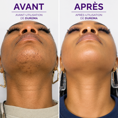 Sérum Anti-Repousse Végétal