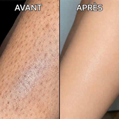 Sérum Anti-Repousse Végétal
